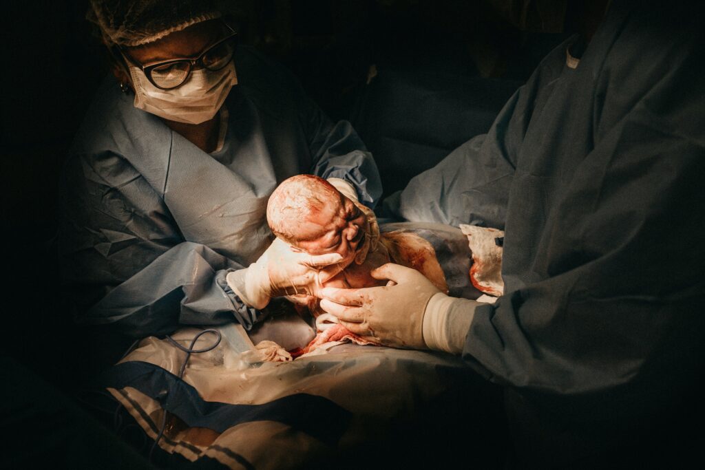 Induction of Labor Increases Risk of C-Section